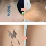 🏆 Last Day Special Price £9.99 ! 🔥Buy 2 Get 1 Free🎁 Gentle Effective Multi-Use Tattoo Fading Cream - Image 5